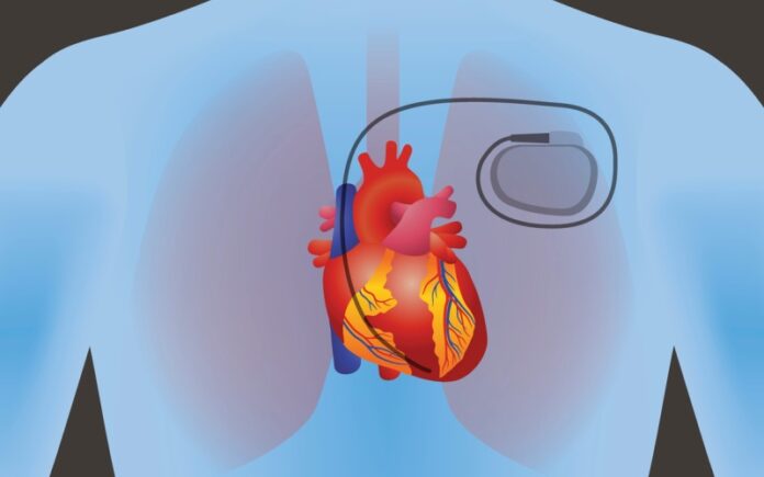 La nanotecnología israelí puede usar la energía del cuerpo para generar energía para marcapasos y más