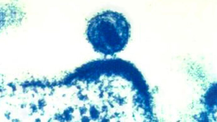 Investigadores israelíes desarrollan tecnología de edición de genes para combatir el virus del VIH