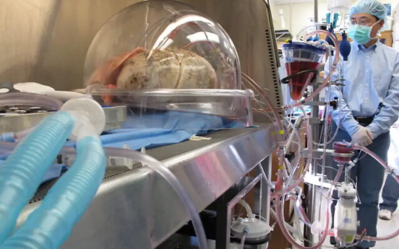 Pulmones donados como parte de una investigación en la Universidad de Carolina del Norte, Chapel Hill, se sientan dentro de una máquina mientras se ventilan y se analizan para ver si están lo suficientemente sanos para trasplantarlos, en 2013. (AP/Allen G. Breed)